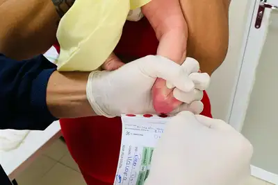 notícia: Hospital da Mulher Mãe Luzia realiza cerca de 350 testes do pezinho por mês em Macapá; saiba como é realizado